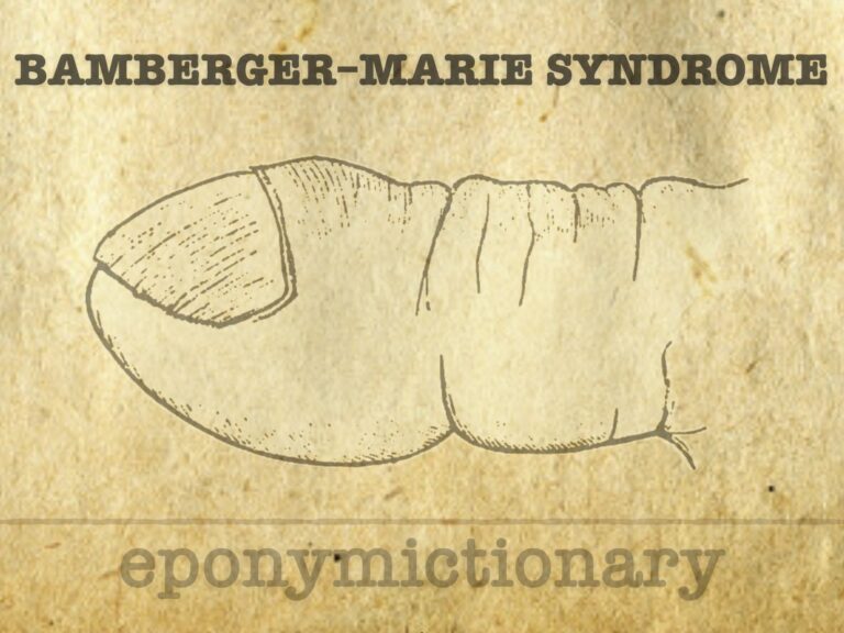 BAMBERGER–MARIE SYNDROME 680