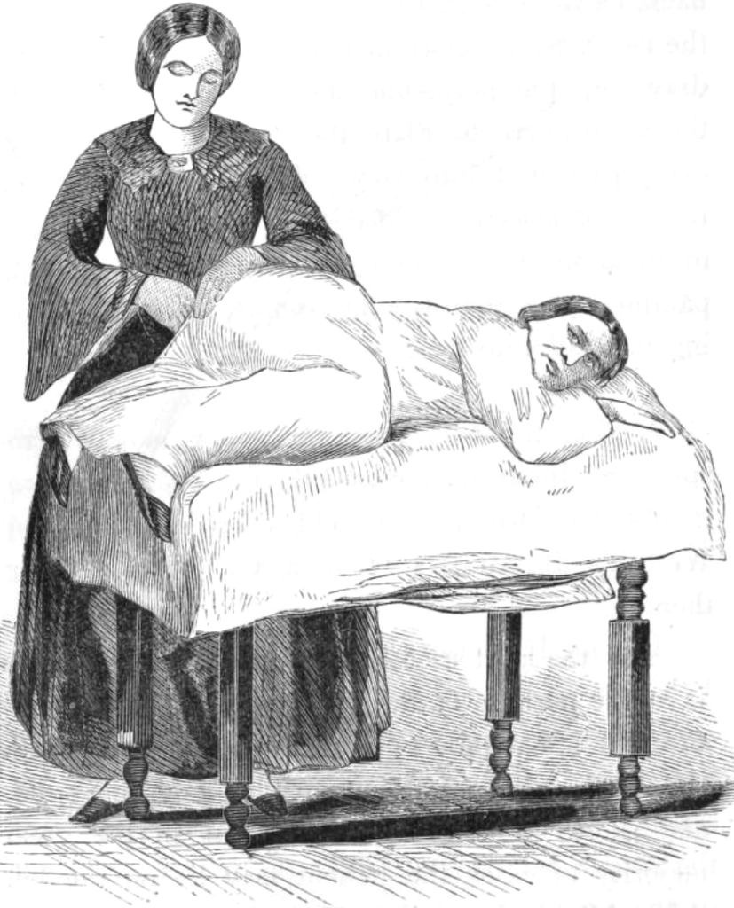 Sims Position Silver Sutures in Surgery 1858
