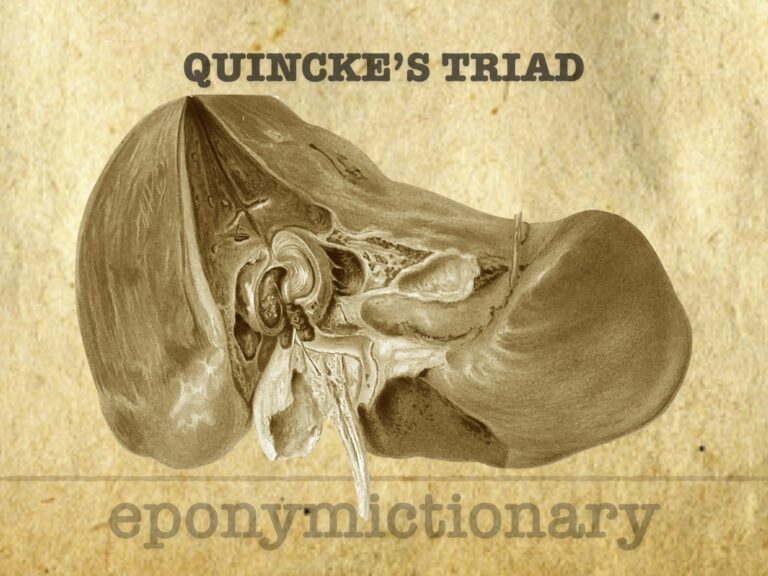 Quincke’s Triad 680