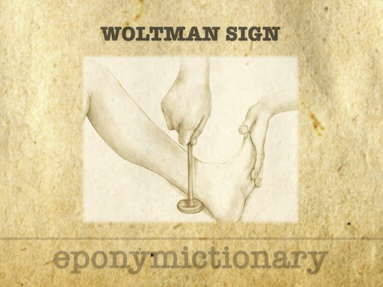 Woltman sign of myxoedema 680