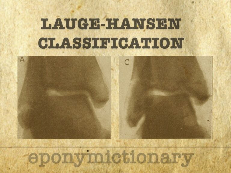 Lauge-Hansen classification of ankle injury 680