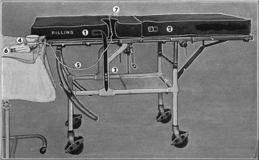 The Lemmon Mattress for epidural anaesthesia 1940