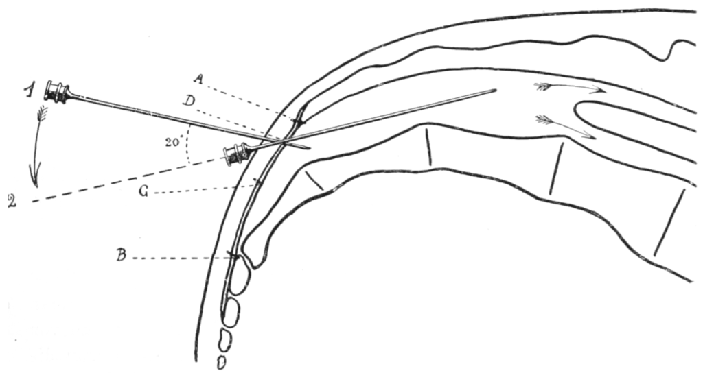 Die-beiden-Zeiten-der-Punktion 2
