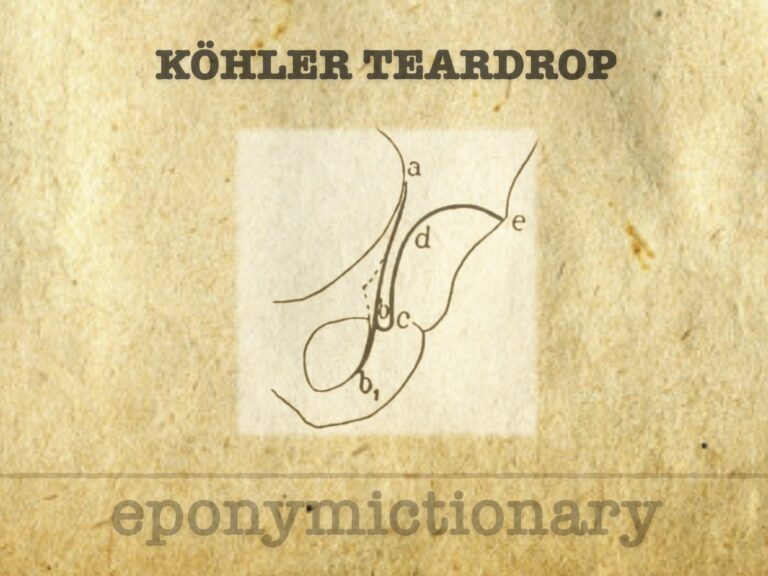 Köhler teardrop 680