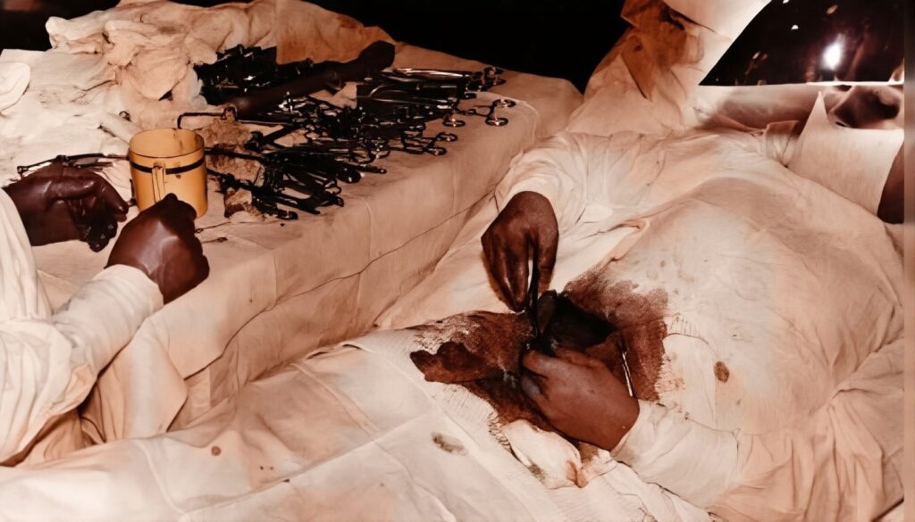 Leonid Rogozov auto-appendicectomy April 30 1961 mirror 2