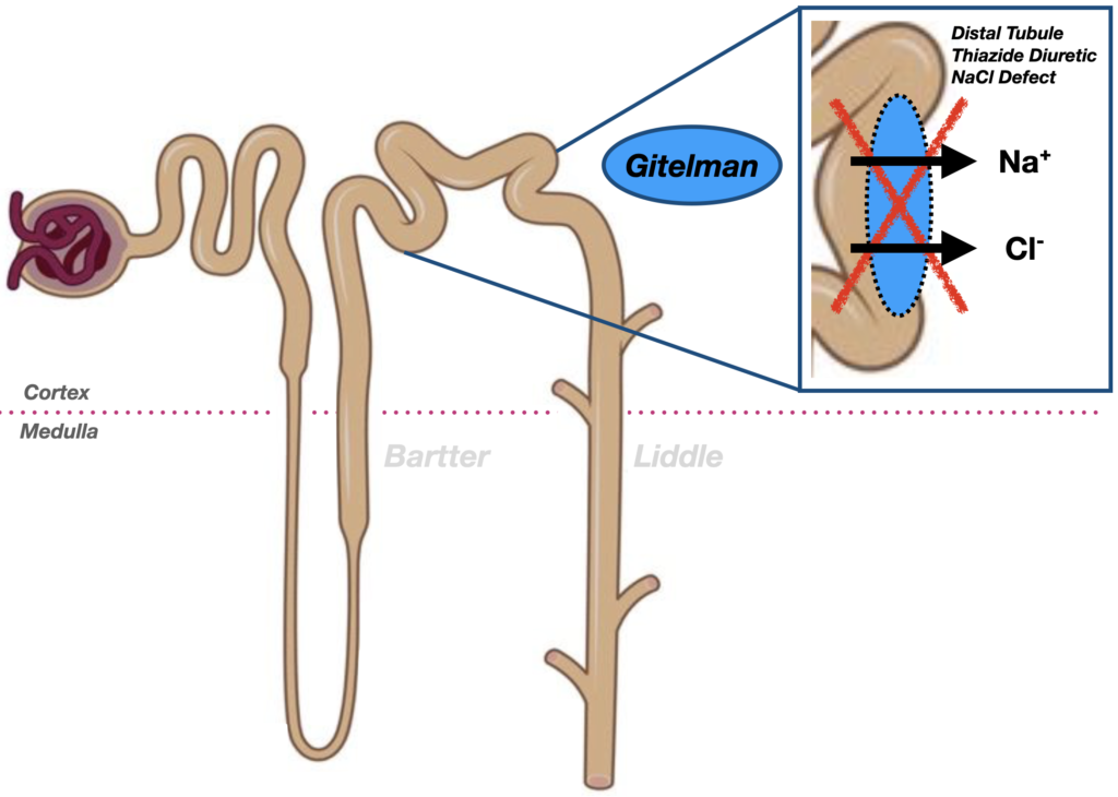 Gitelman Syndrome channelopathy 2