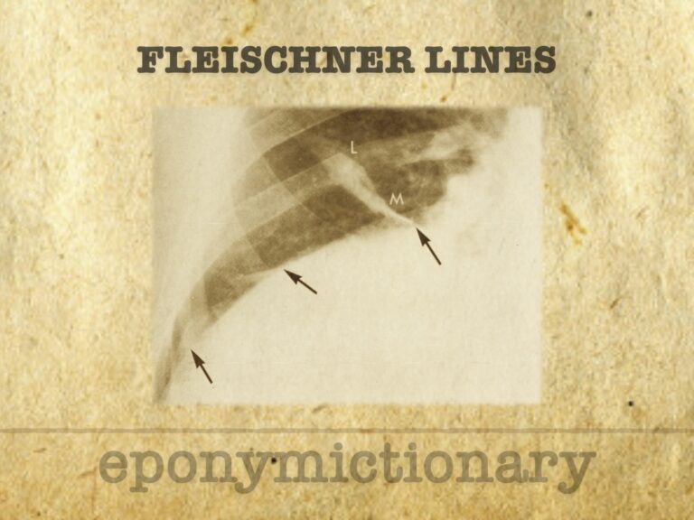 Fleischner lines 680