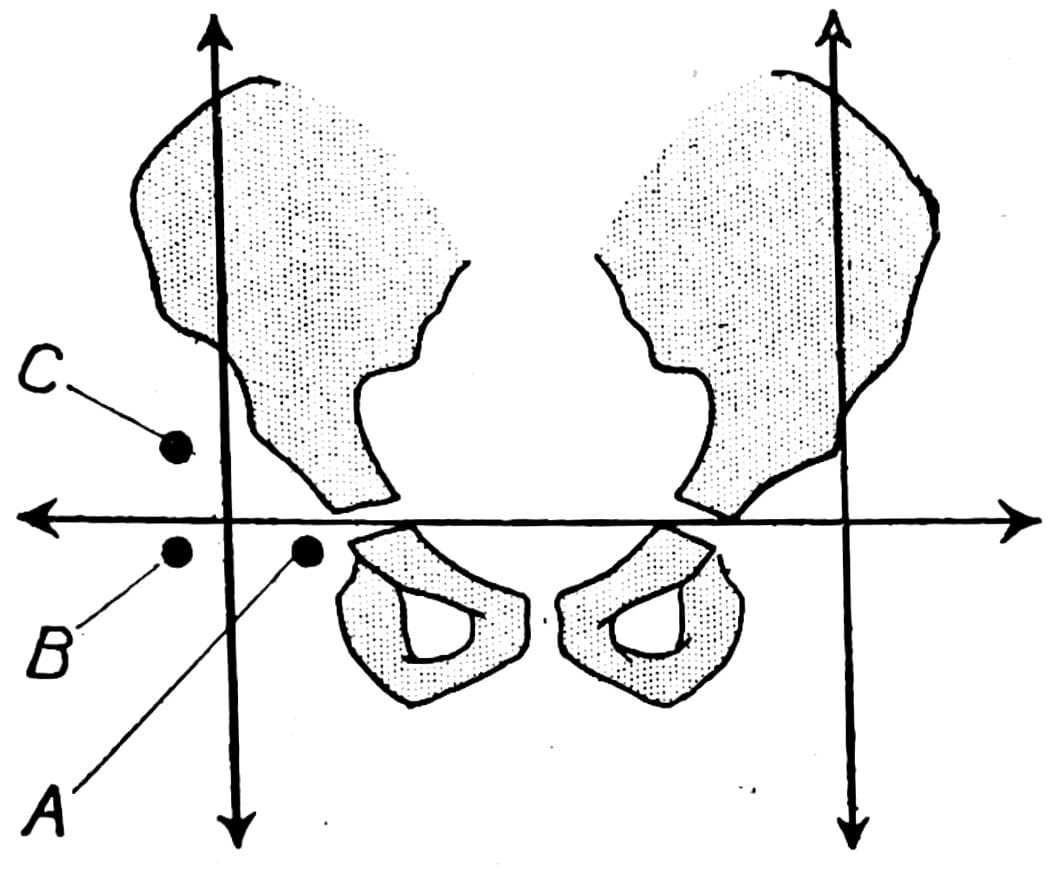 Ombrédanne quadrants and the Ombrédanne-Perkins line 1923