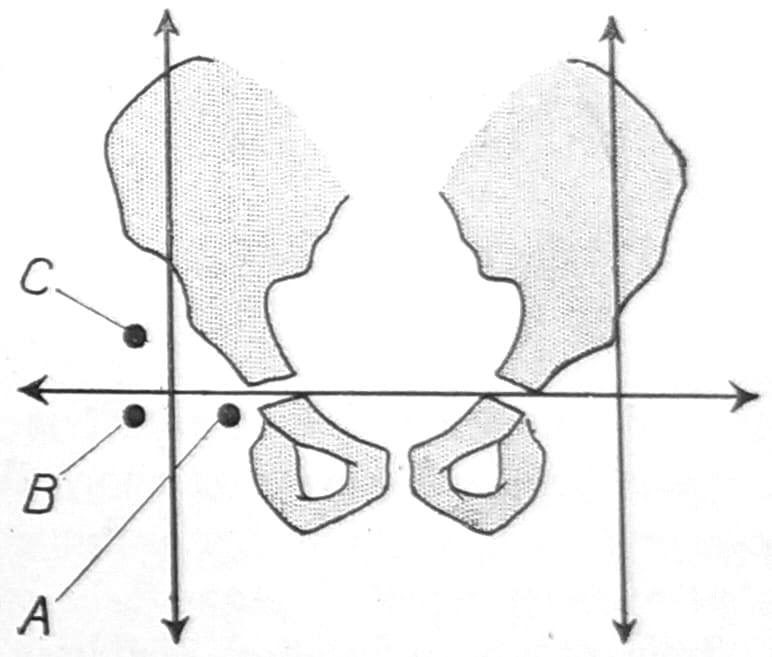 Ombrédanne quadrants 1932