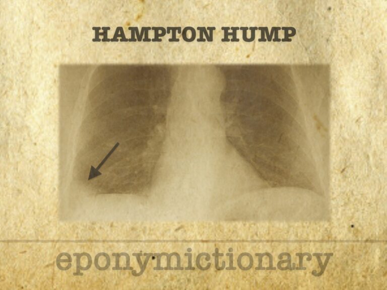 Hampton hump 680