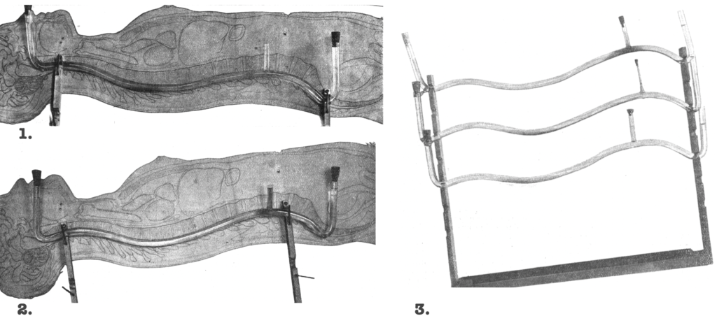 Barker glass spine 1907