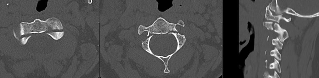 CT Case 107 Hangman