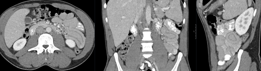 CT Case 108