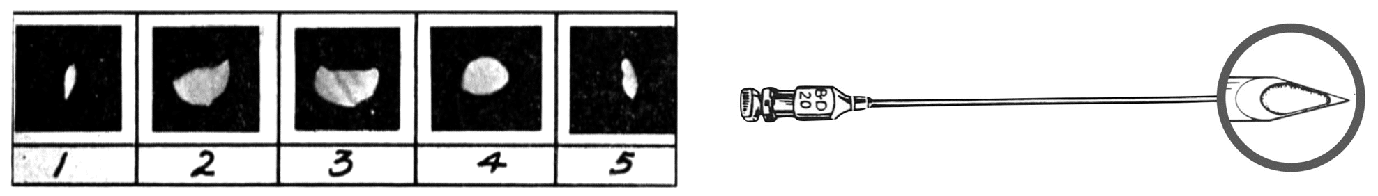 Greene needle and micrographs