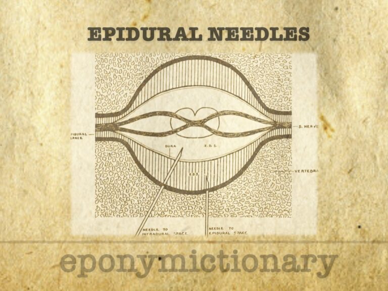 History of epidural needles and catheters 680