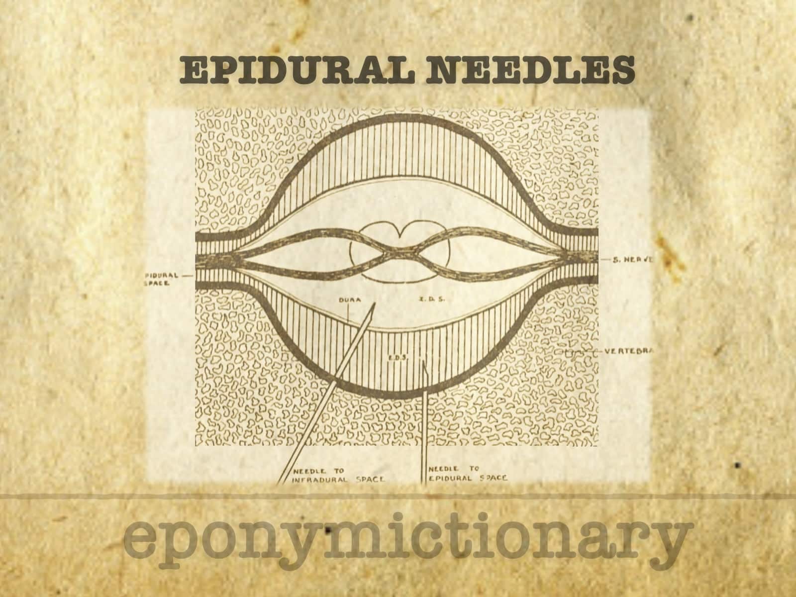 History of Epidural Needles and Catheters LITFL