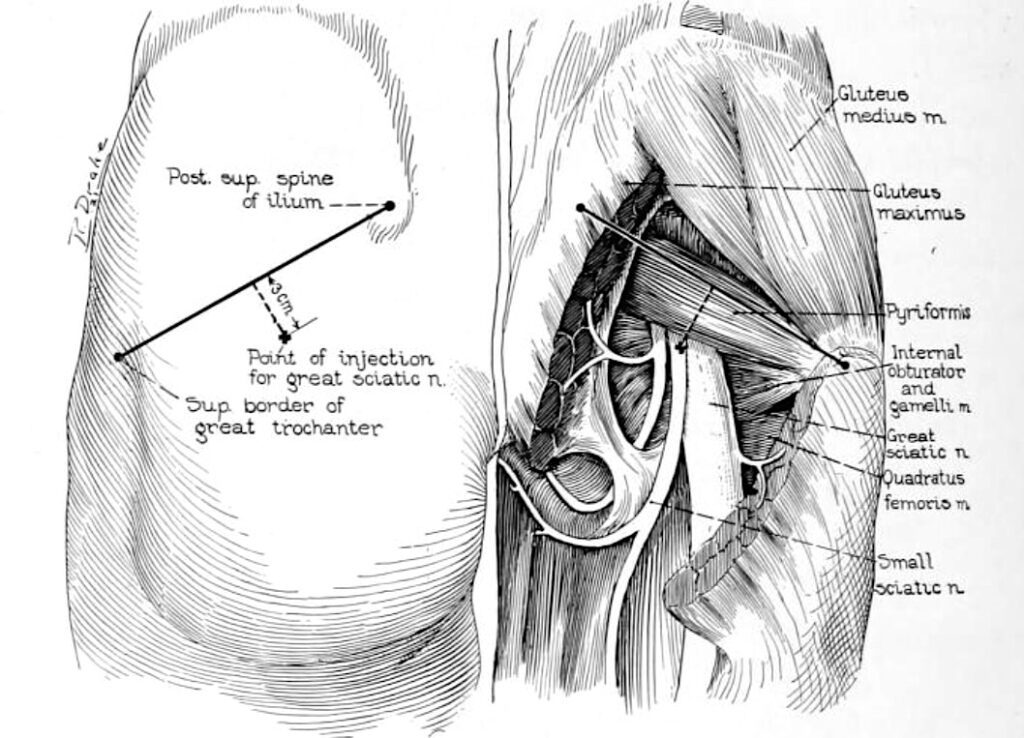 Labat approach surface landmarks and deep anatomy
