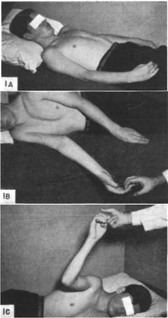 Twitchell Brain 1951