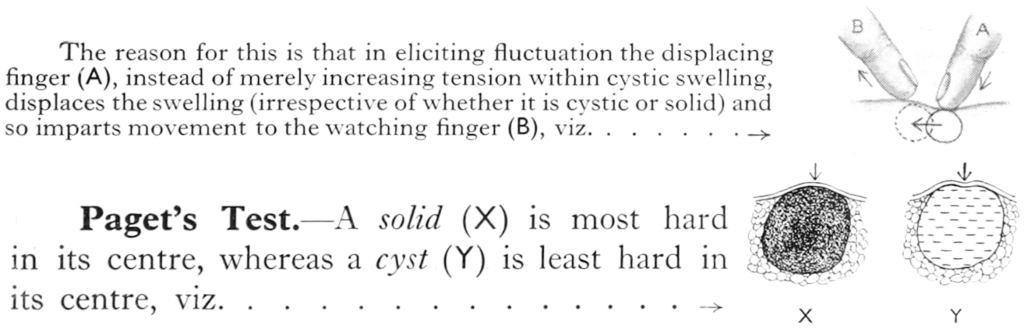 Paget's Test