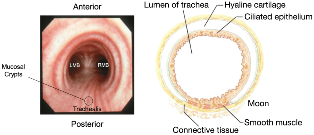 Bronchoscopic Orientation