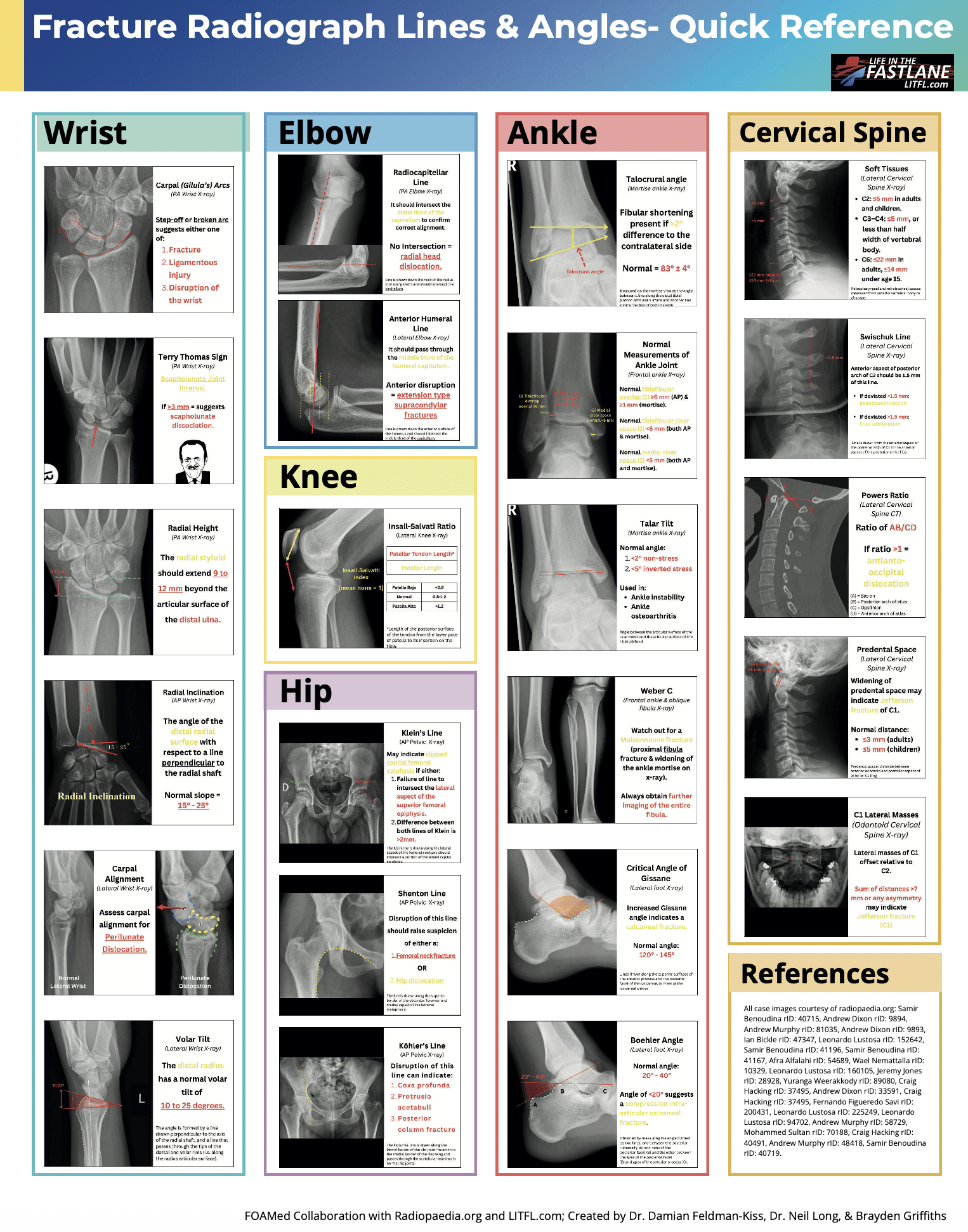 Fracture-Radiograph-Lines-Angles 1