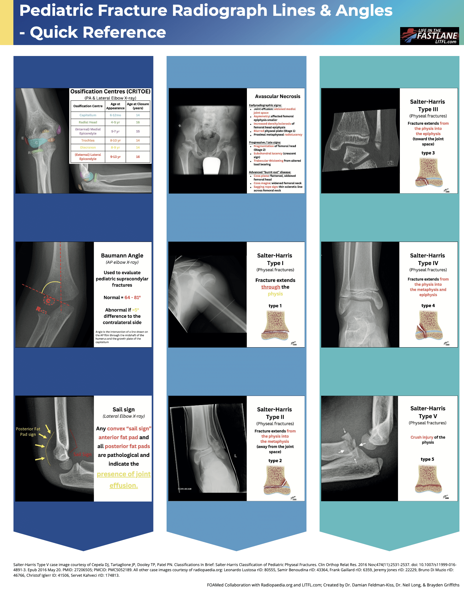 Fracture-Radiograph-Lines-Angles 2