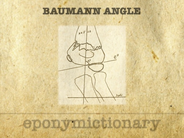 Baumann angle 680