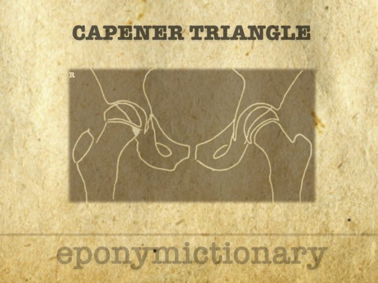 Capener triangle 680