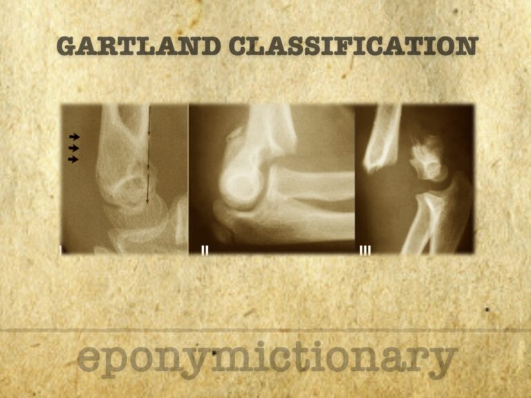 Gartland Classification 680