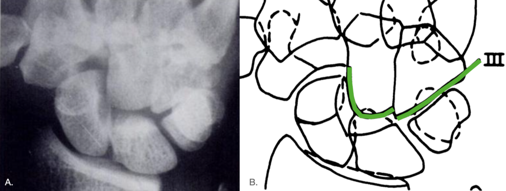 Gilula Arc 3 1979 1