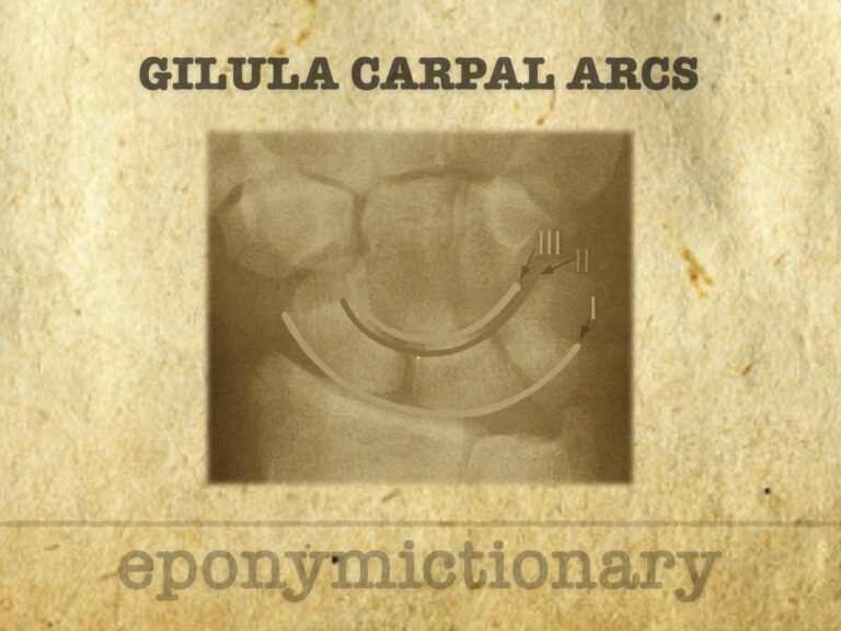 Gilula carpal arcs 680