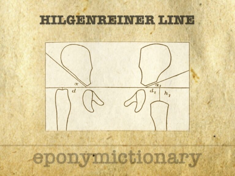 Hilgenreiner line 680