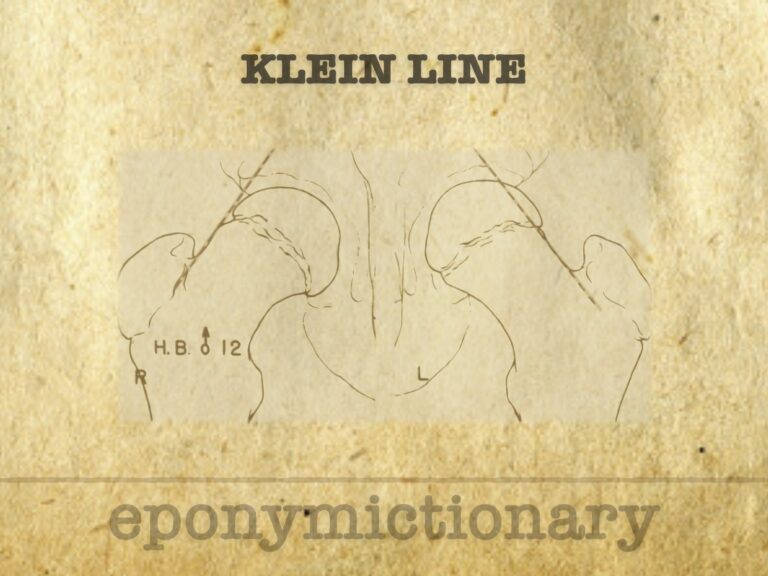 Klein line 680