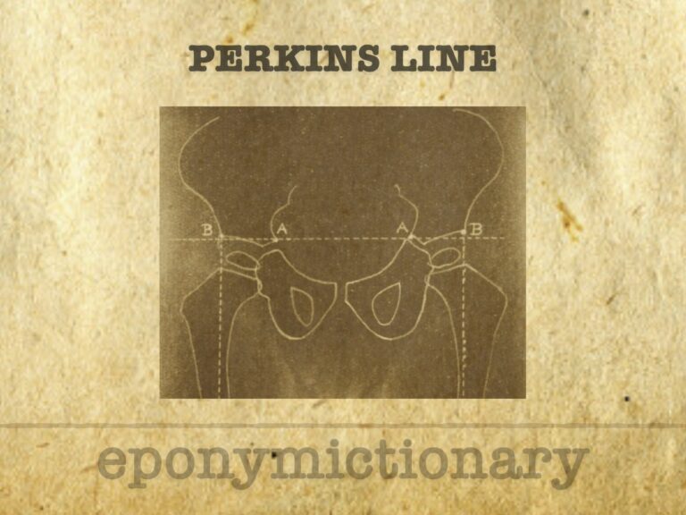 Perkins line 680