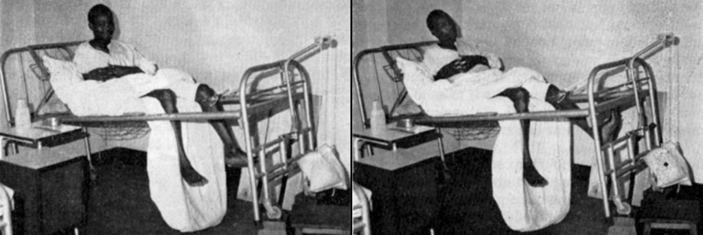 Perkins traction (1958)