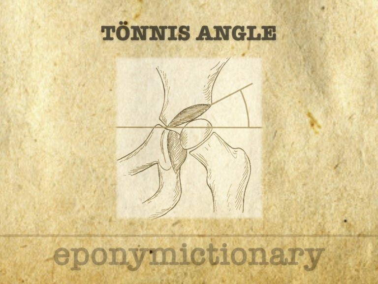 Tönnis angle 680