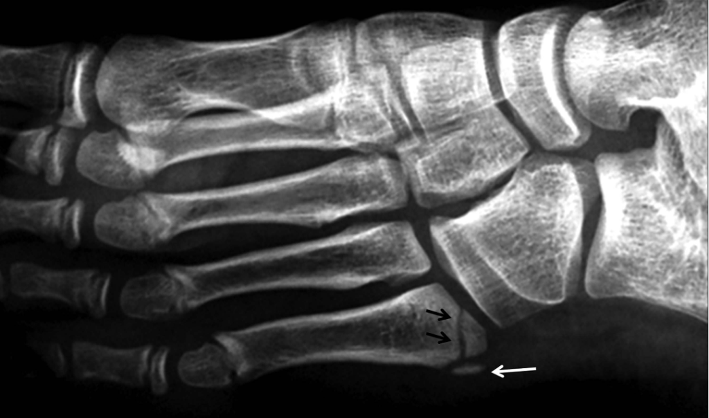 Fig 3 2014 pathology XR