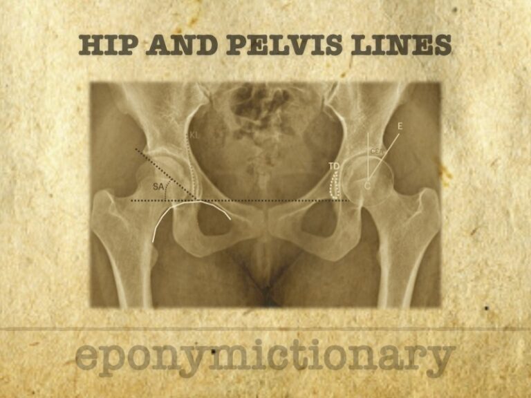 Hip and pelvic lines 680