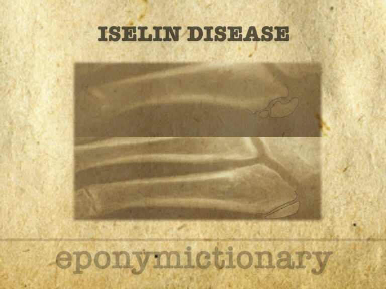 Iselin disease 680