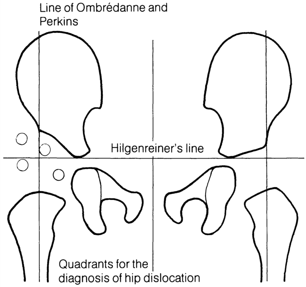 Lines of Hilgenreiner and of Ombredanne and Perkins
