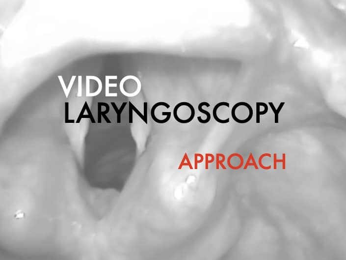 Video laryngoscopy stepwise Approach 680