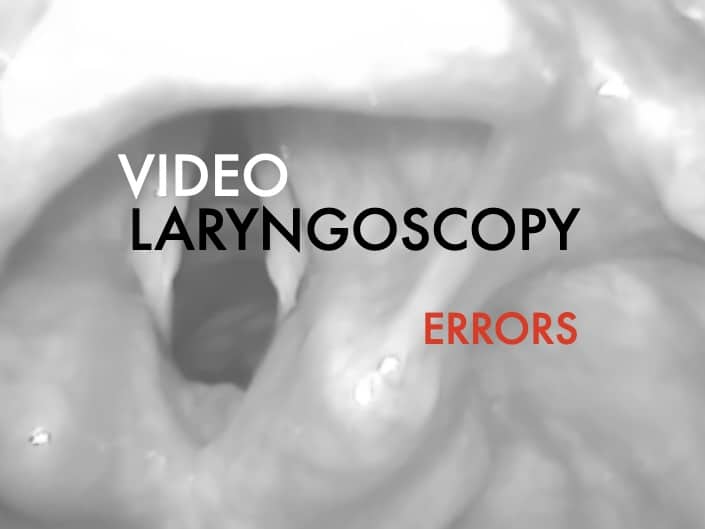 Video laryngoscopy performance errors 680