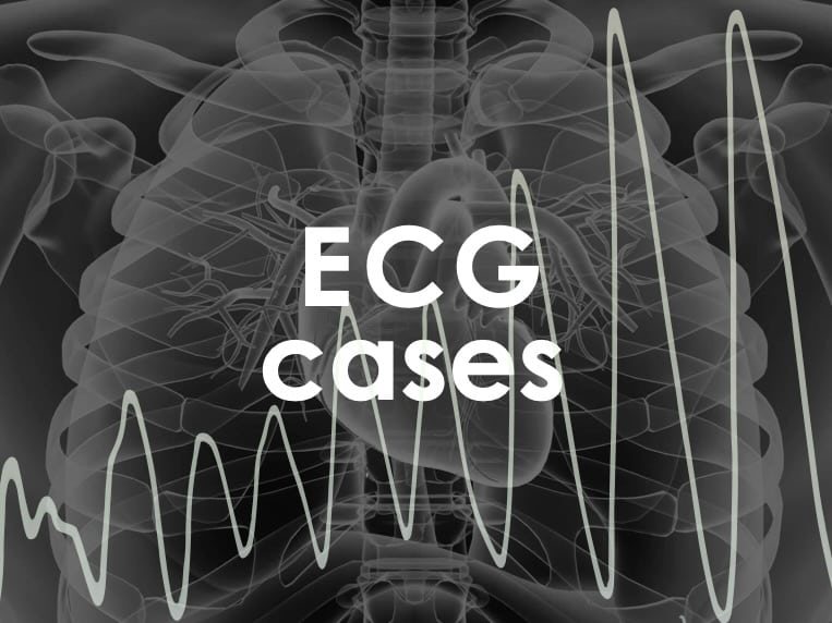 ECG EKG Clinical cases and quiz 680 2